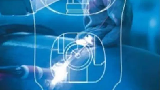 Couverture brochure Albee weld